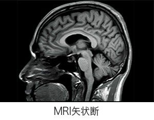 MRI矢状断